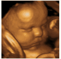 Ultrasound Image